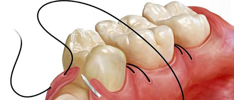 Cirurgia