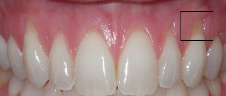 Periodontia